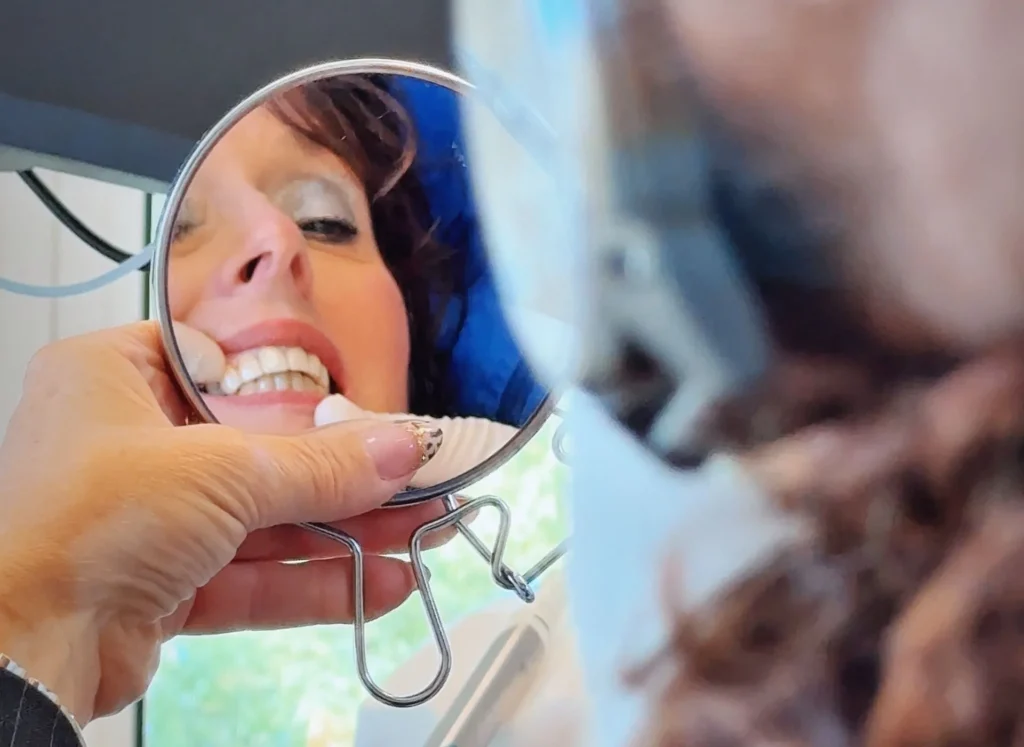 cosa sono le faccette dentali