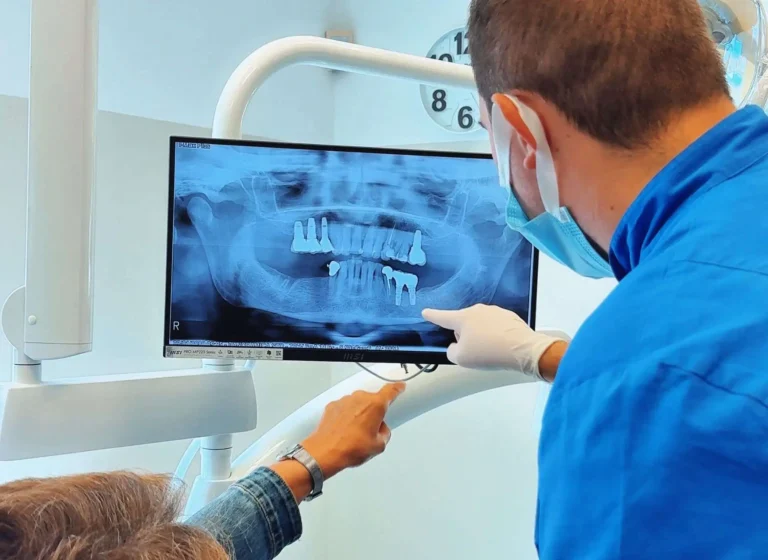 Quanto costa un impianto dentale completo