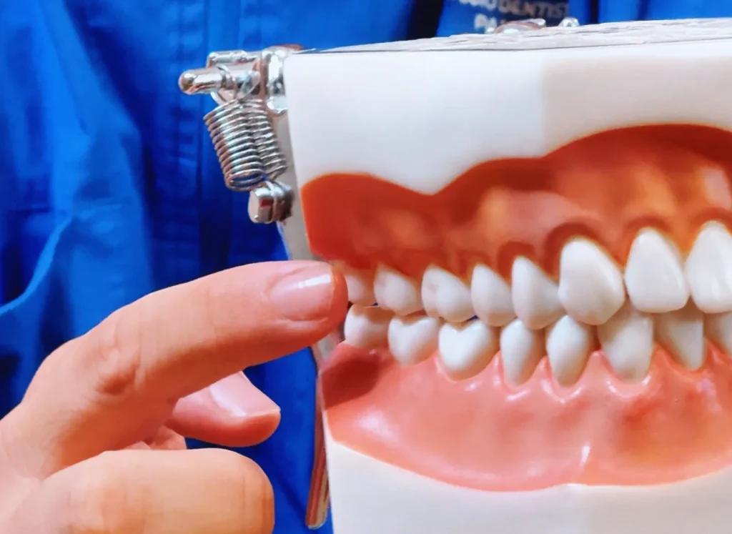 a che età si può fare la pulizia dei denti